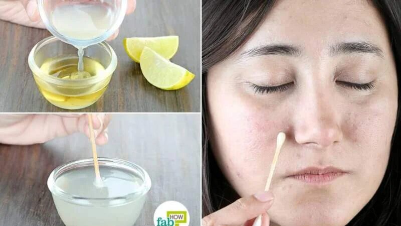 Wellhealthorganic.com/easily-Remove-Dark-Spots-Lemon-Juice