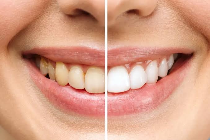 How Family Dentistry Ensures Safe, Effective Smile Transformations